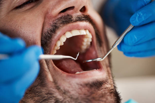 Best Emergency Broken Tooth Repair in Belvedere, CA